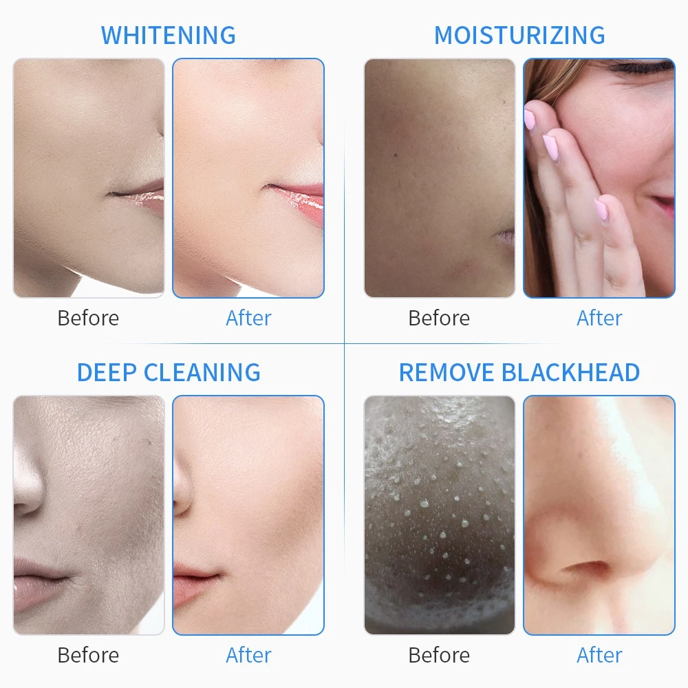 Professional Skin Rejuvenatio - photo 2