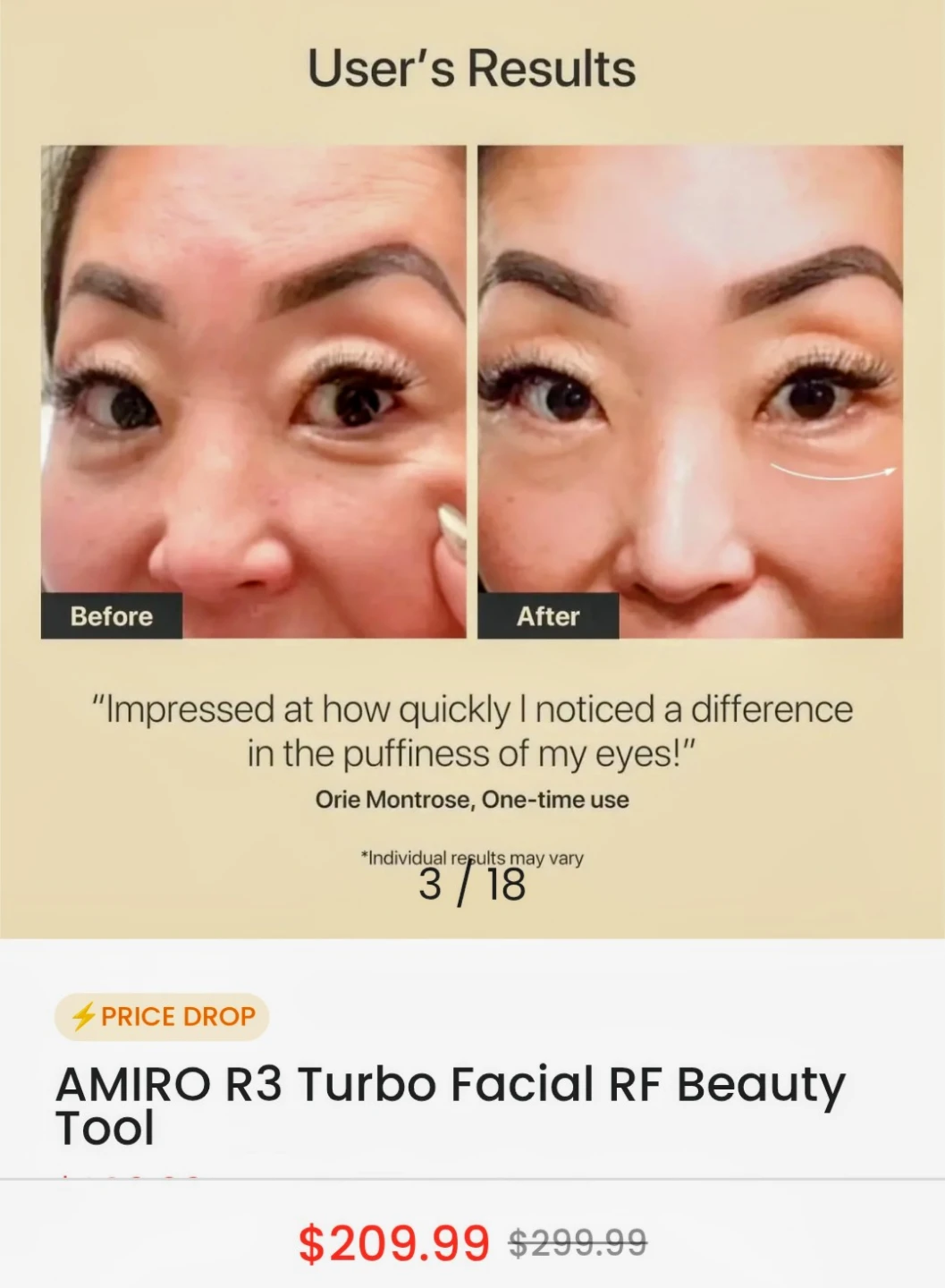 AMIRO R3 Turbo Facial RF Beauty Tool - photo 2