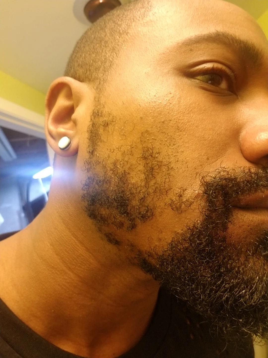 Fuyat Minoxidil 5% with Biotin Hair & Beard Growth Spray - photo 5