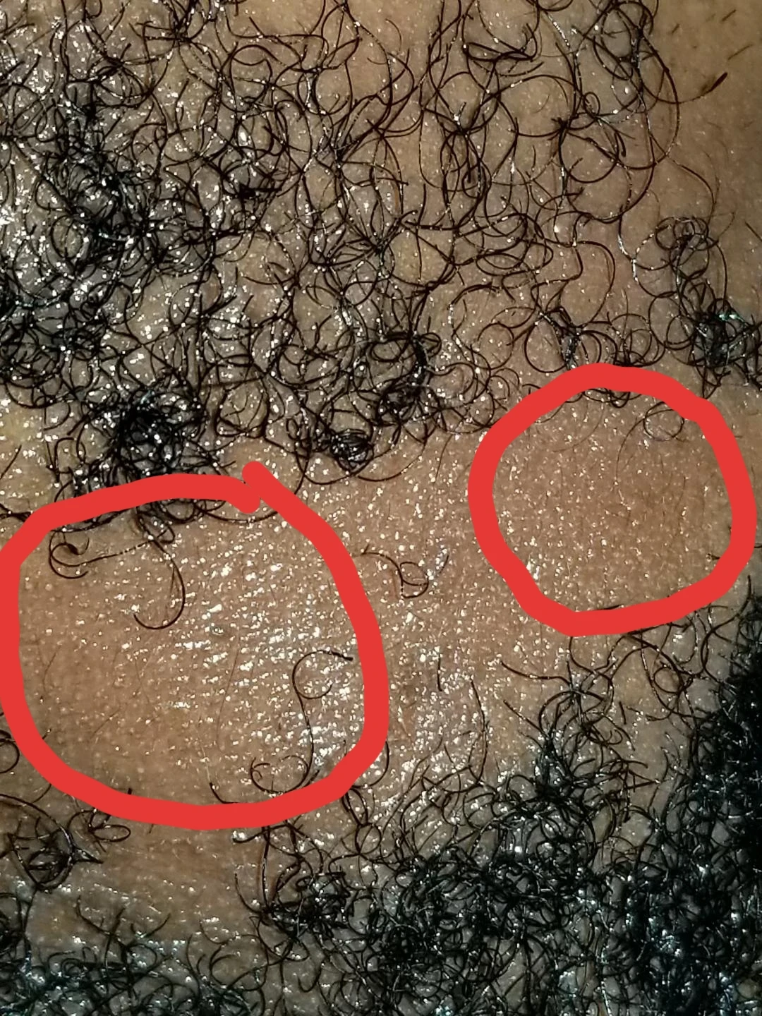 Fuyat Minoxidil 5% with Biotin Hair & Beard Growth Spray - photo 5