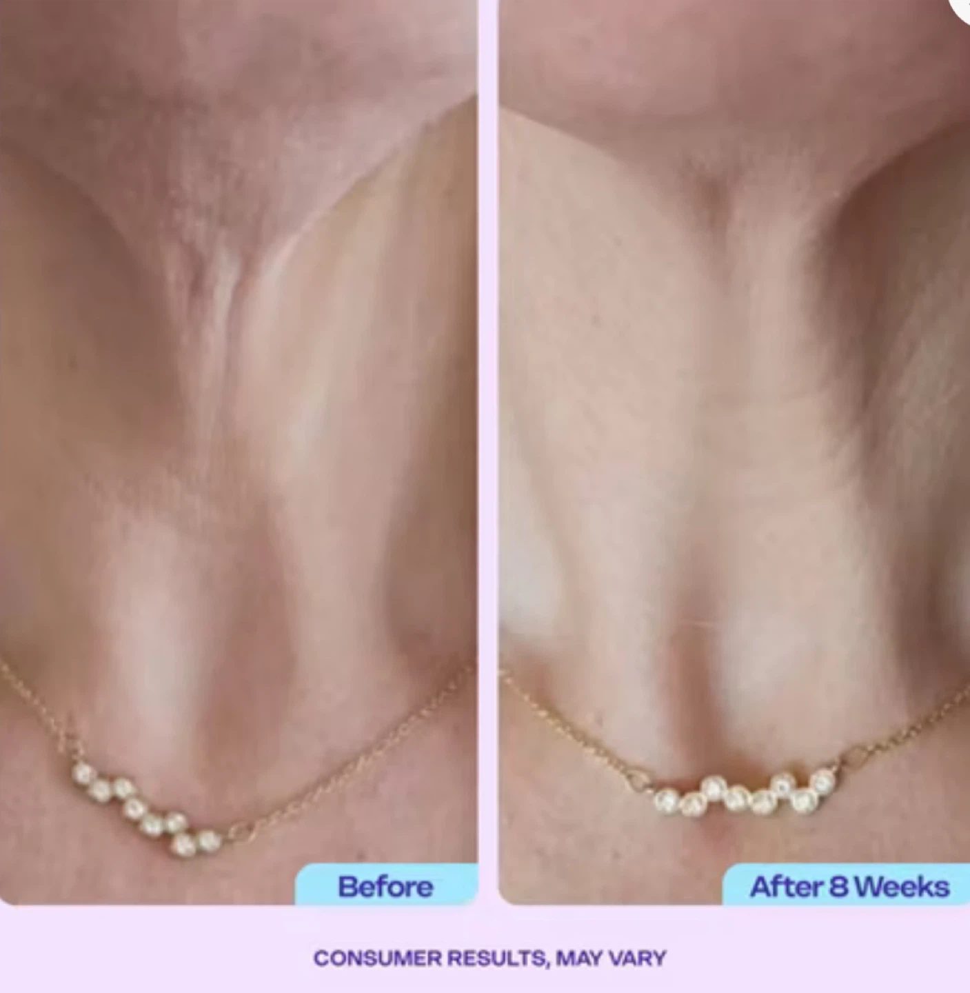 GoPure Tighten & Lift Neck Cream - photo 3