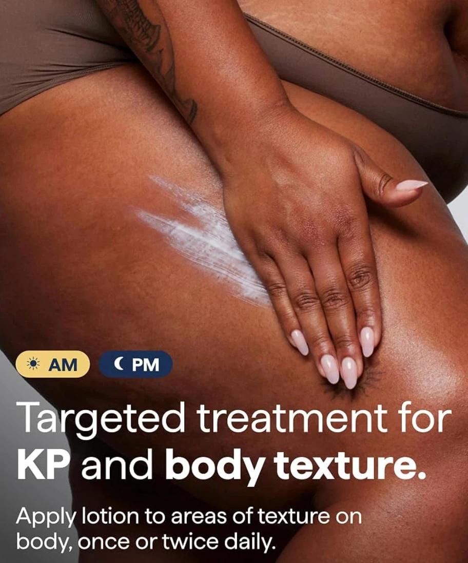 Remedy for body bumps KP and textured skin treatment lotion - photo 5