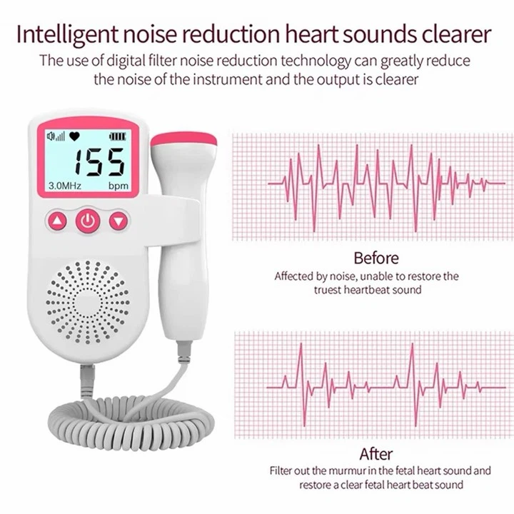 Fetal Doppler - photo 2