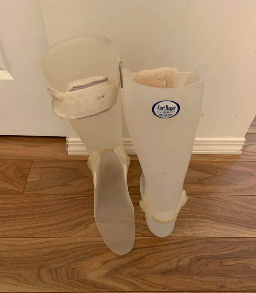Karl Hager Prosthetic Sockets - photo 2