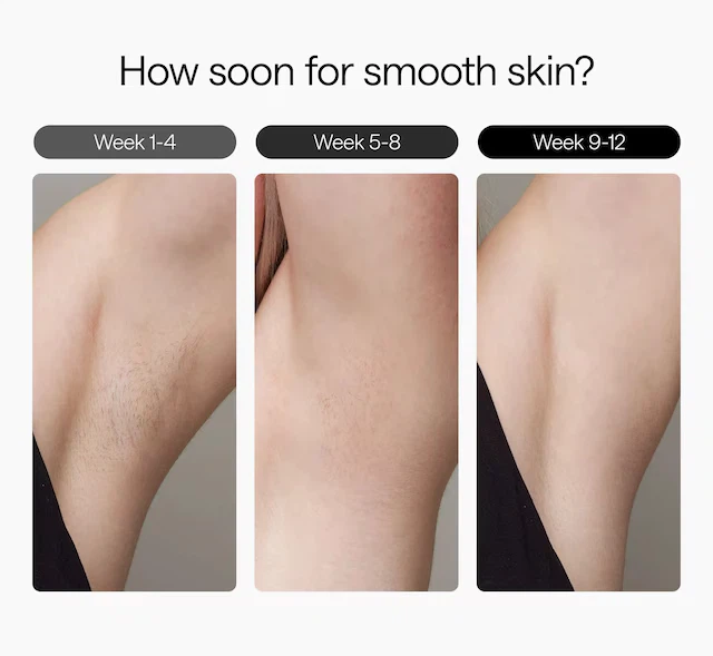 Ulike Air 3 IPL Hair Removal Device - Ice Cooling - photo 5
