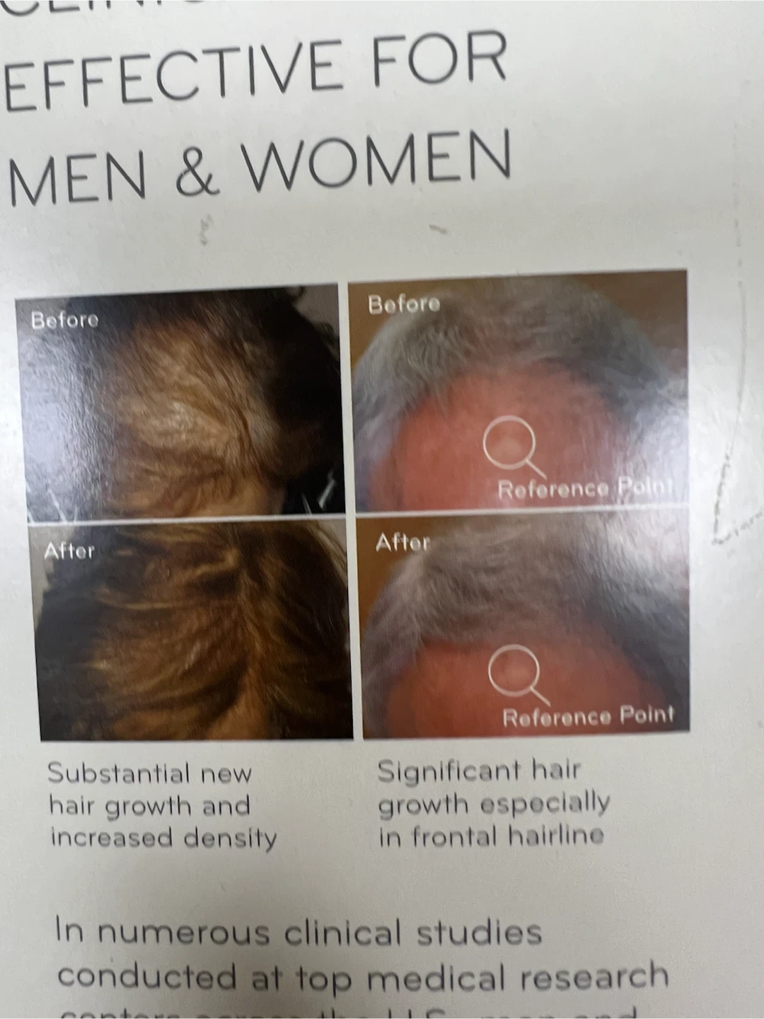 HairMax Premium Lux 9 LaserComb Hair Growth Device - photo 4