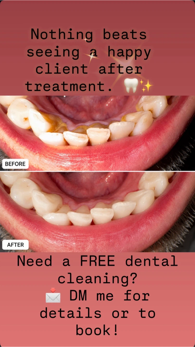 Free dental cleaning