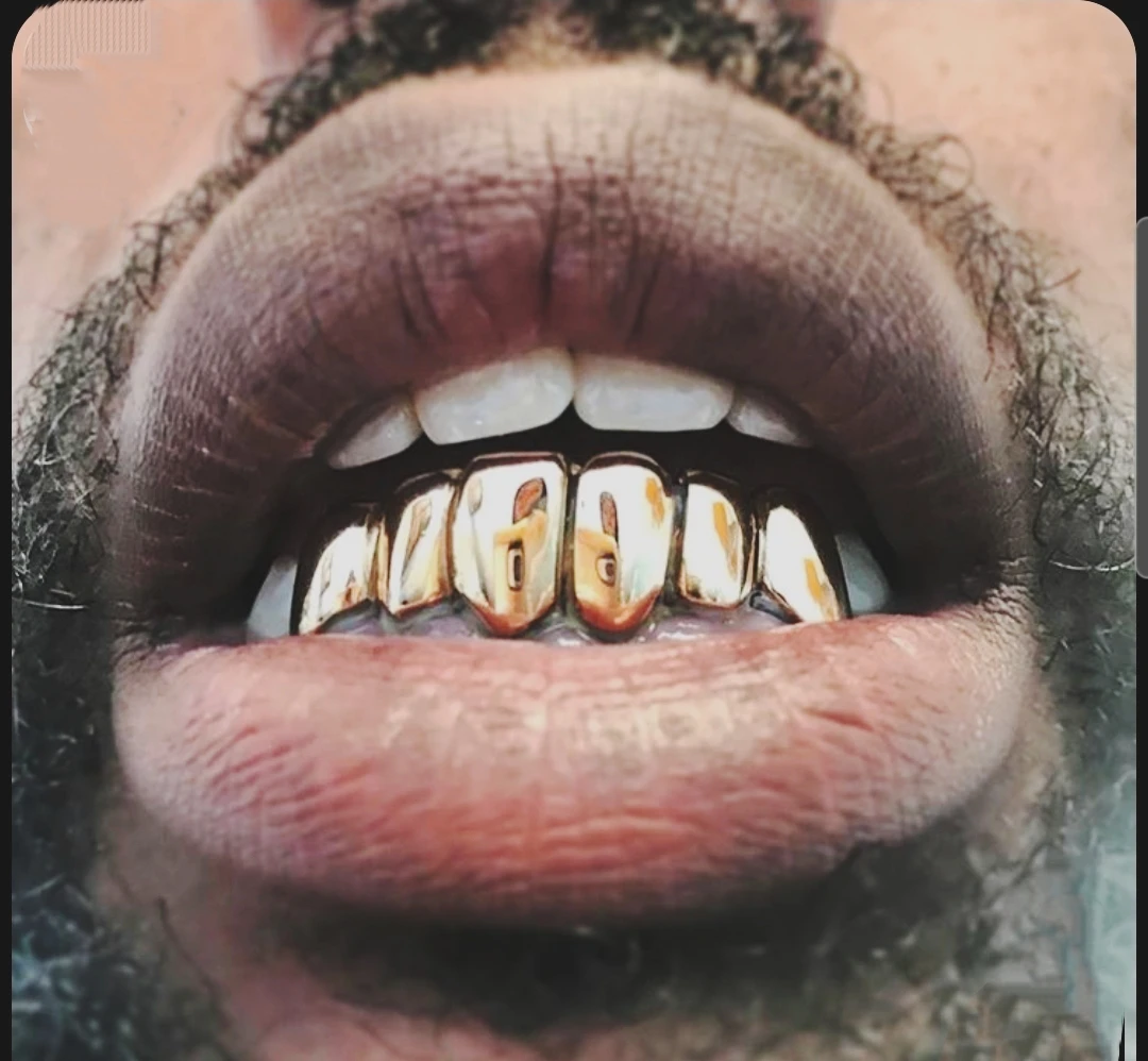 Gold Grillz for Teeth