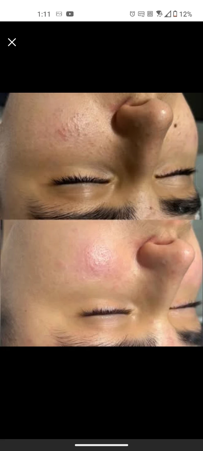 men's facial cleansing - photo 5