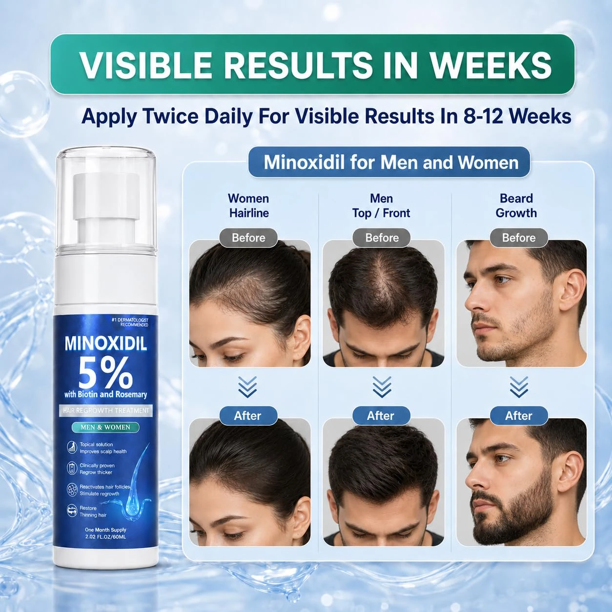 NEW Hair Growth Serum for Hair Beard Regrowth - photo 5