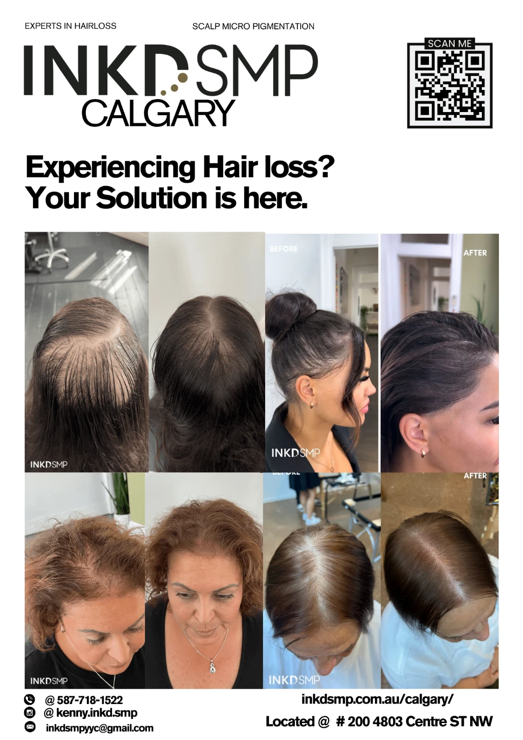 INKD SMP Scalp Micro Pigmentation Services