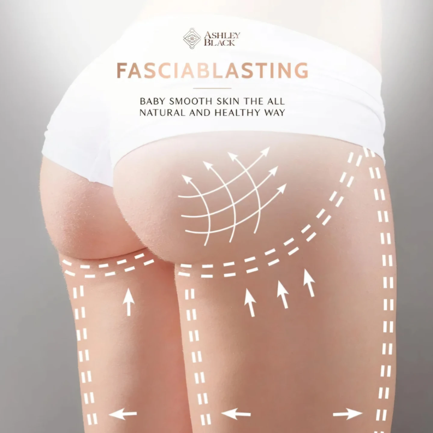 Ashley Black FasciaBlaster Bar + Nugget for Cellulite - photo 3