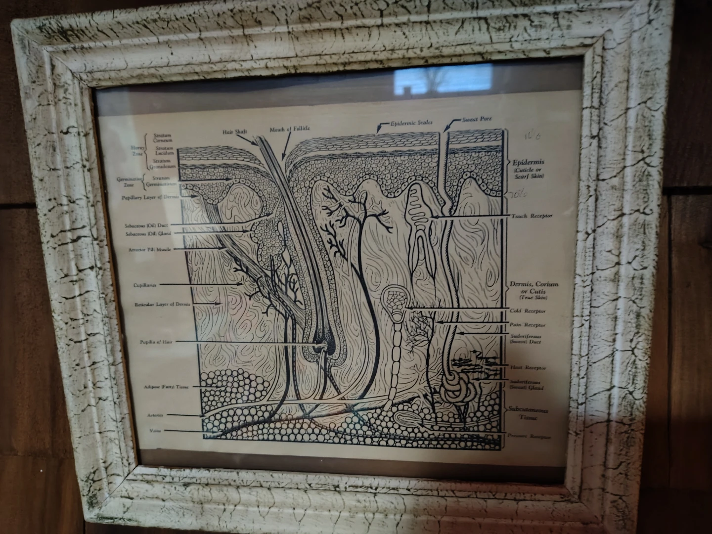 Framed Diagram of Human Skin Anatomy