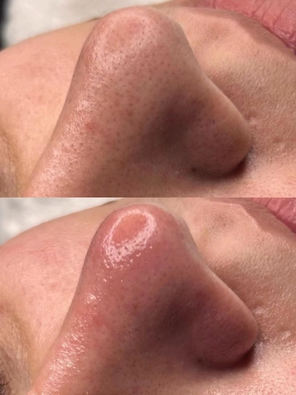 men's facial cleansing - photo 2