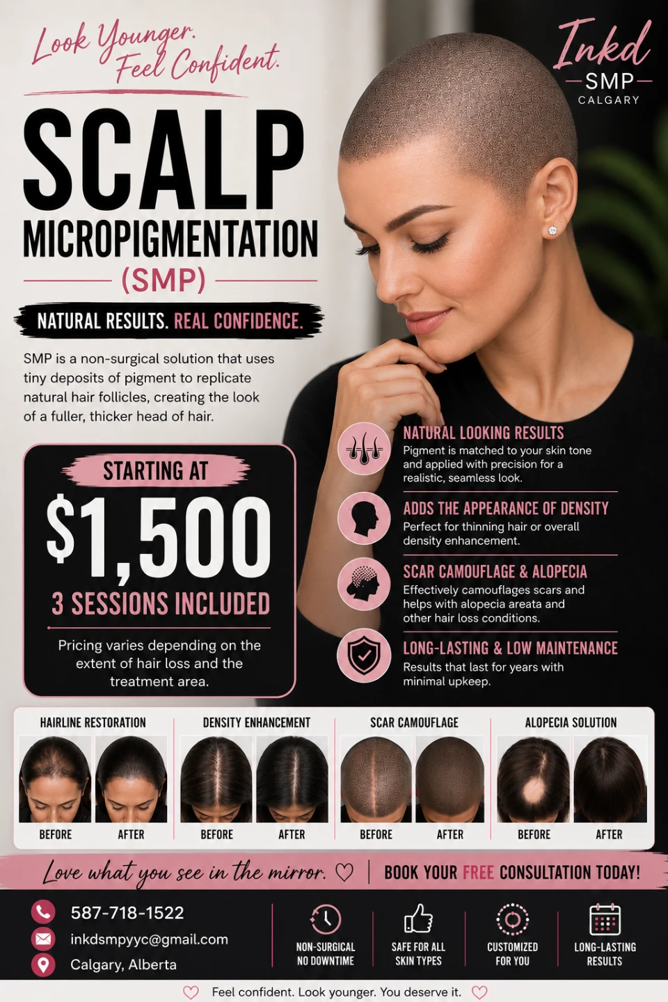 Inkd Calgary Scalp Micropigmentation (SMP) Service