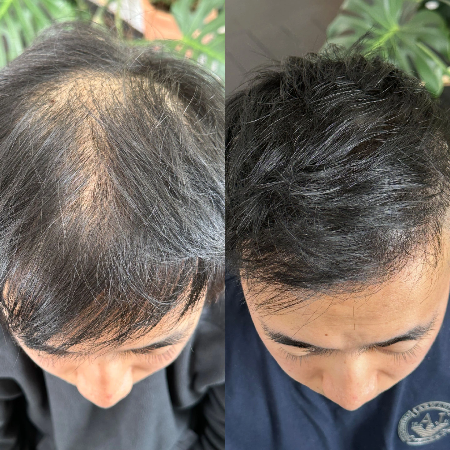 Inkd Calgary Scalp Micropigmentation (SMP) Service - photo 4