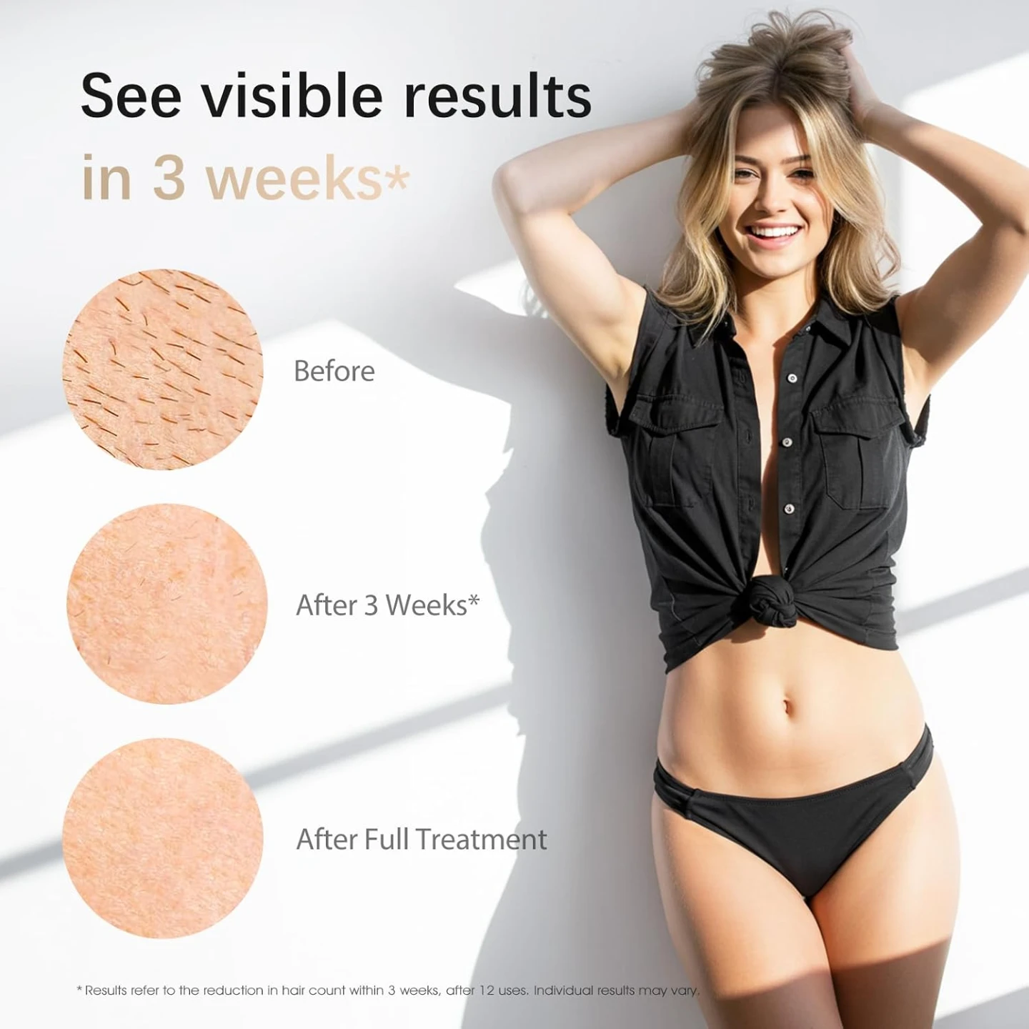 NEW IPL Laser Hair Removal Device for light/medium skin tones - photo 4