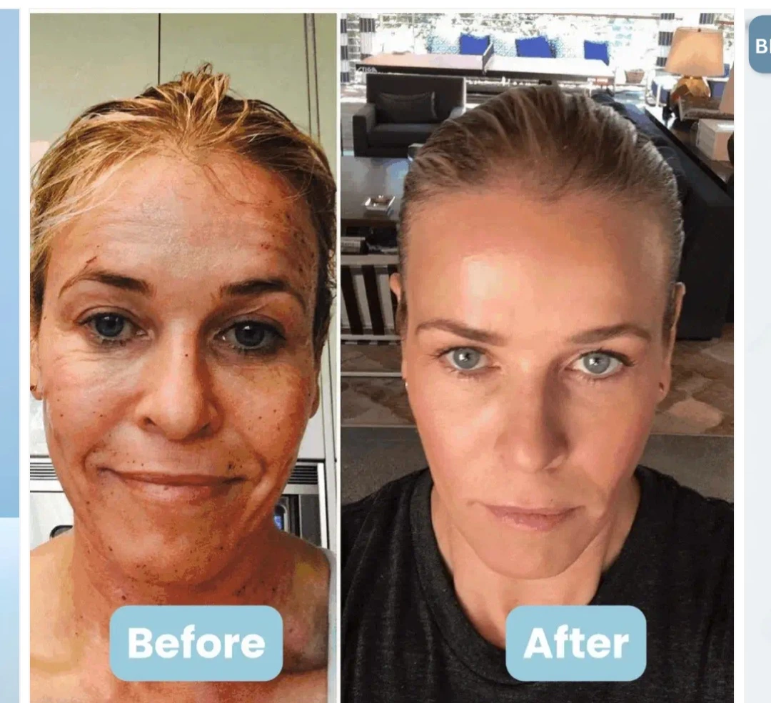 DERMAWELL 3-in-1 LED Facial Sculptor - photo 5