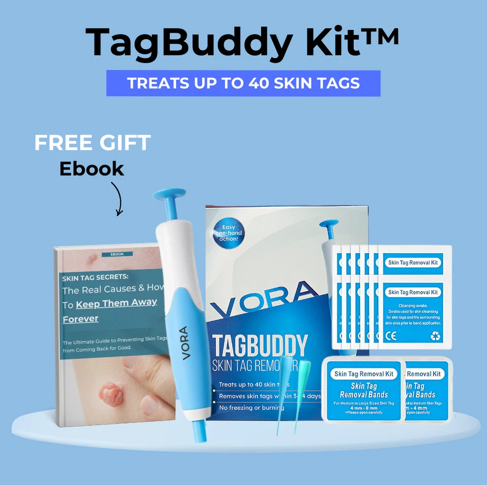 VORA TagBuddy Kit Skin Tag Removal System - photo 2