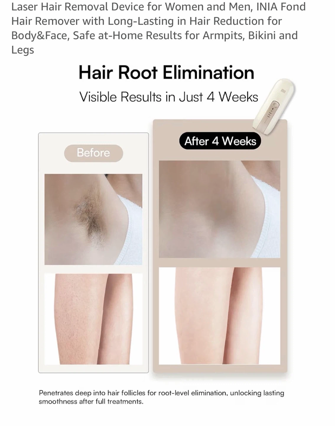 INIA Hair Removal Device - photo 2