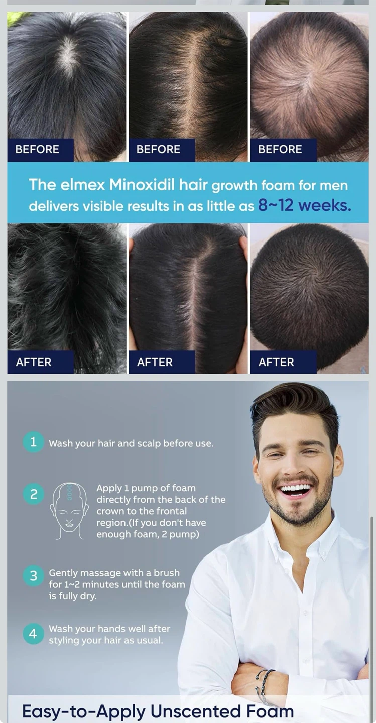 5% Minoxidil Foam for Men and Women, Minoxidil for hair growth - photo 4