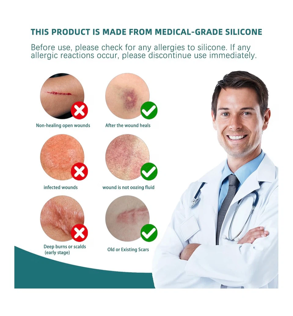 Silicone Scar Tape - photo 2
