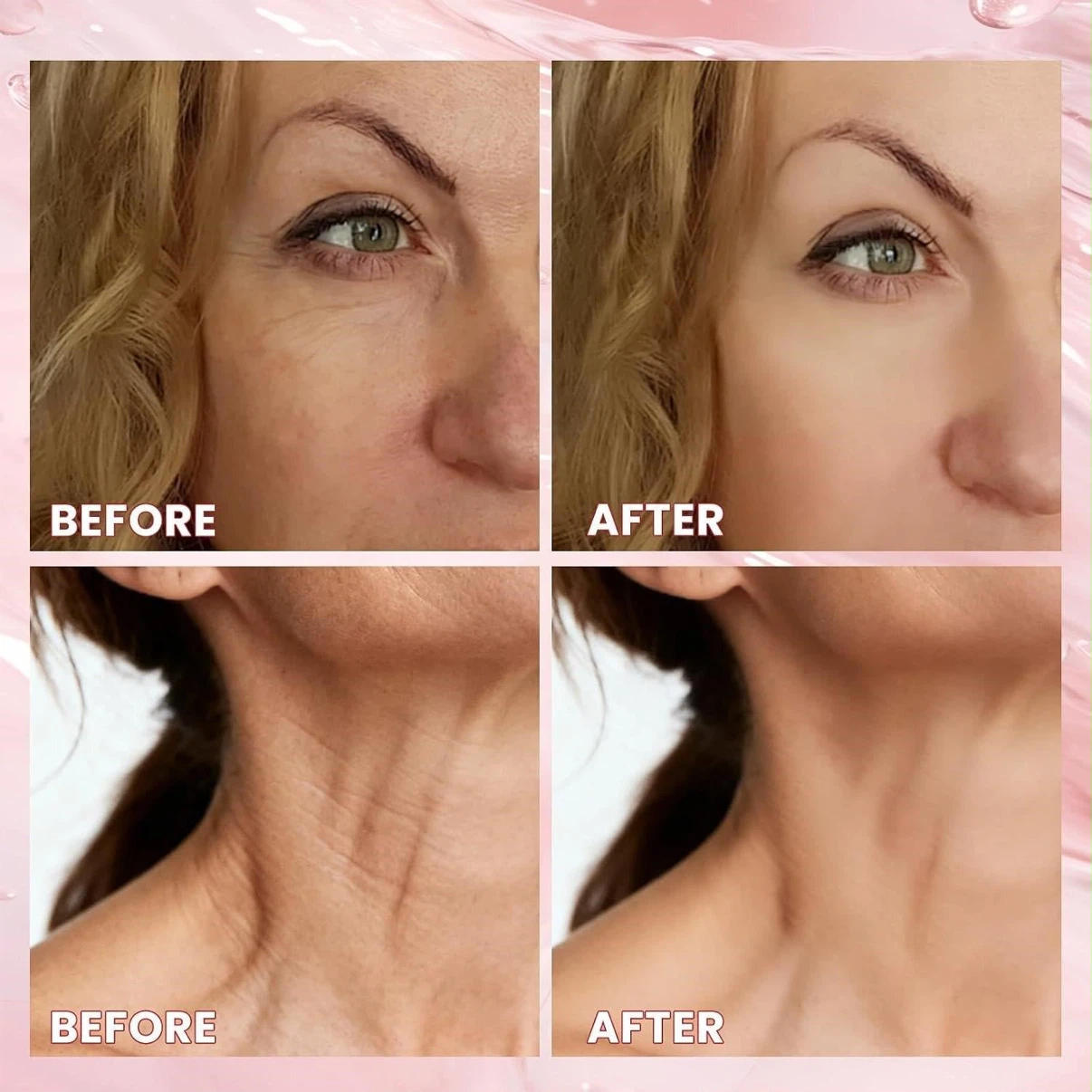 Denstyle Microneedle Infusion Anti-Aging Serum Kit - photo 3