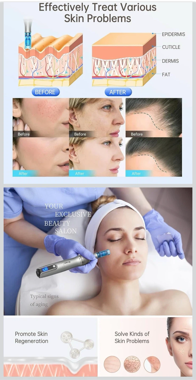 Dr. Pen Microneedling Pen Kit - photo 5