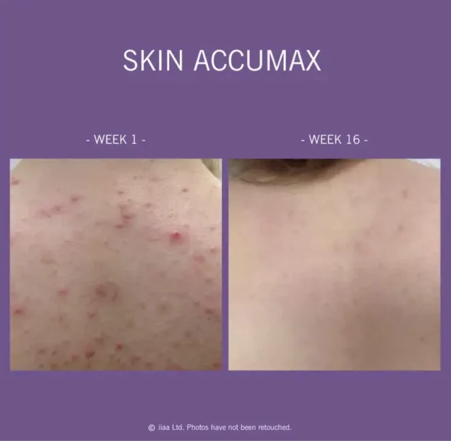 Skin Accumax® by Advanced Nutrition Programme™ - Brand new - photo 3