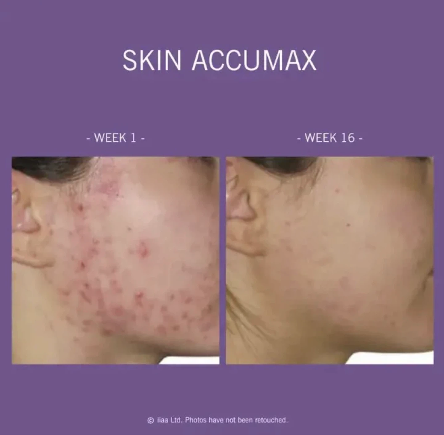 Skin Accumax® by Advanced Nutrition Programme™ - Brand new - photo 2
