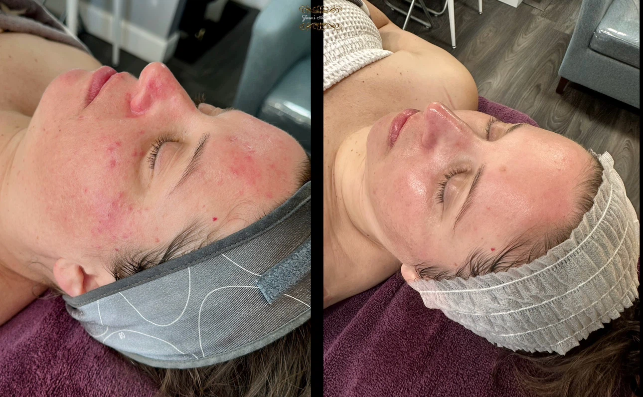 Aesthetic salon services - photo 3