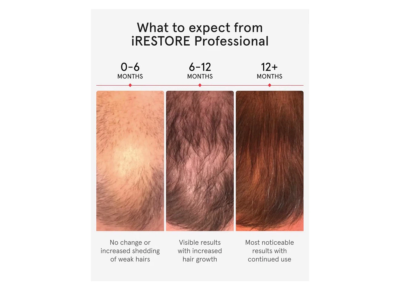 iRESTORE Professional Hair Growth Helmet - photo 3