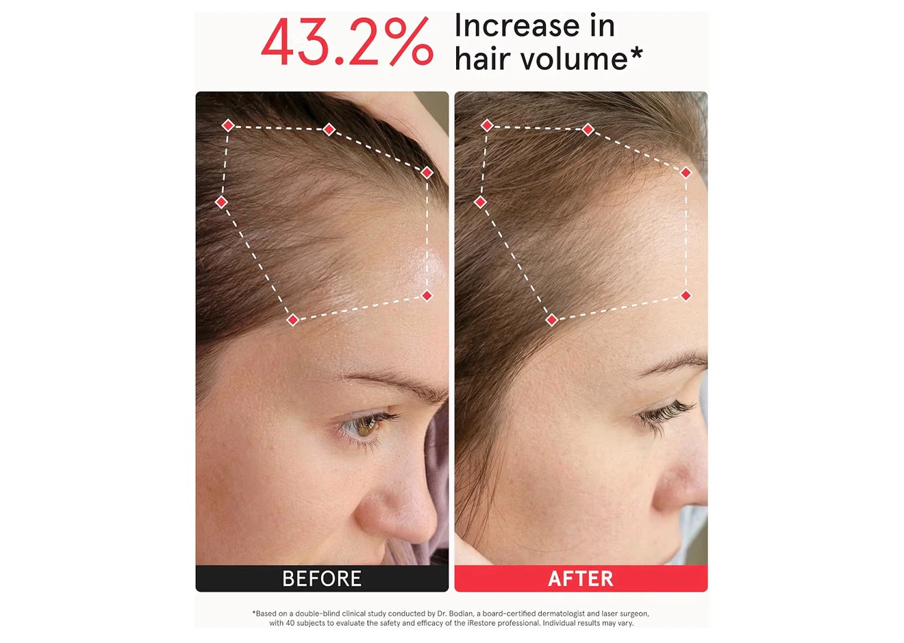 iRESTORE Professional Hair Growth Helmet - photo 5