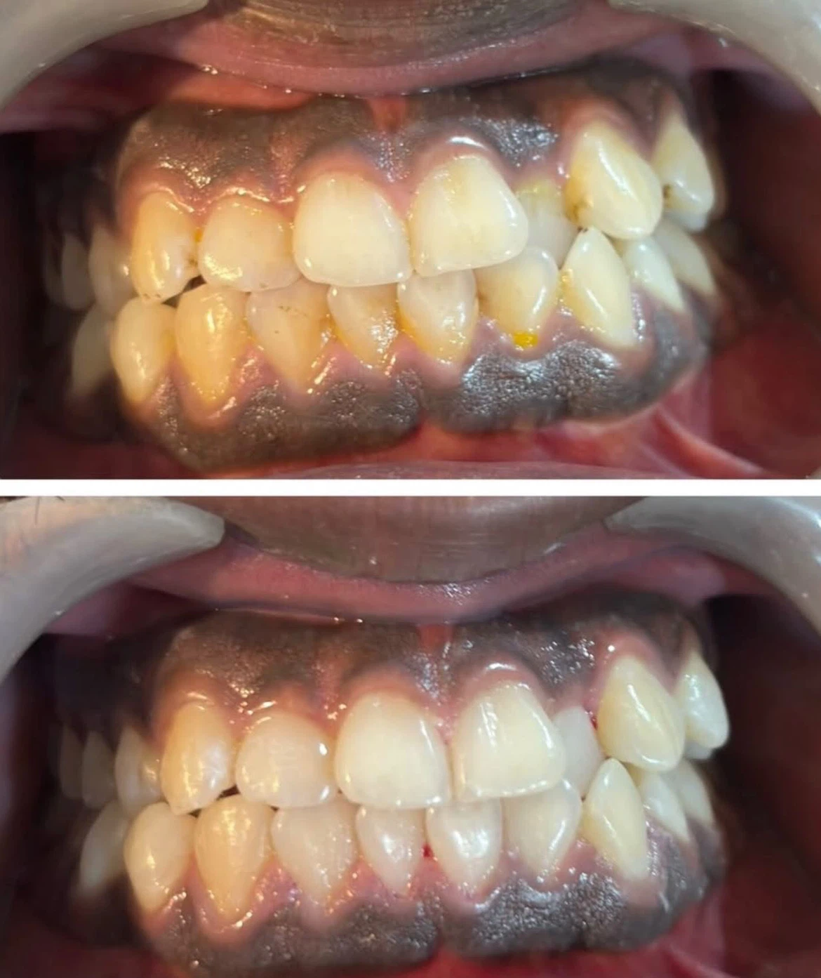 Free dental cleaning - photo 2
