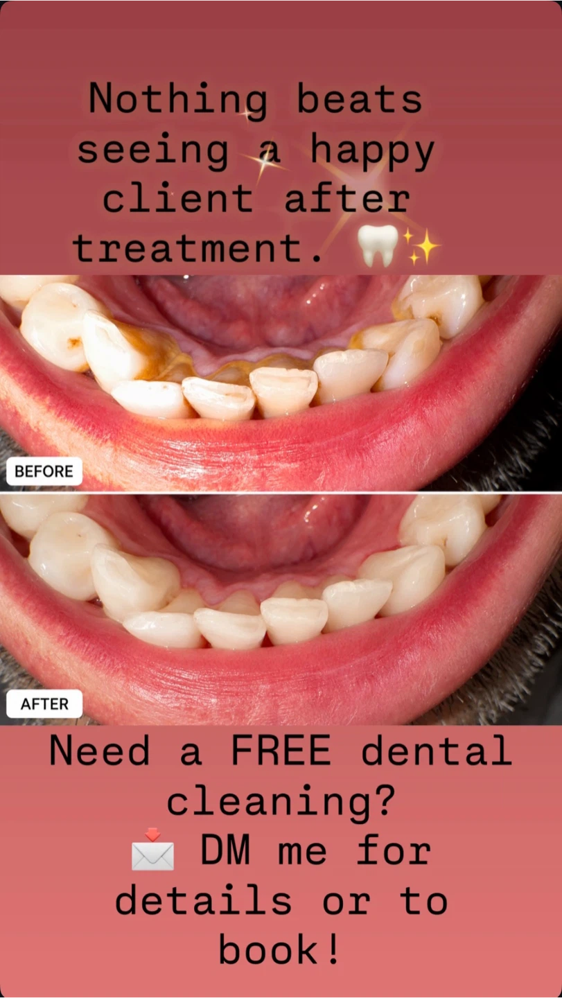 Free dental cleaning