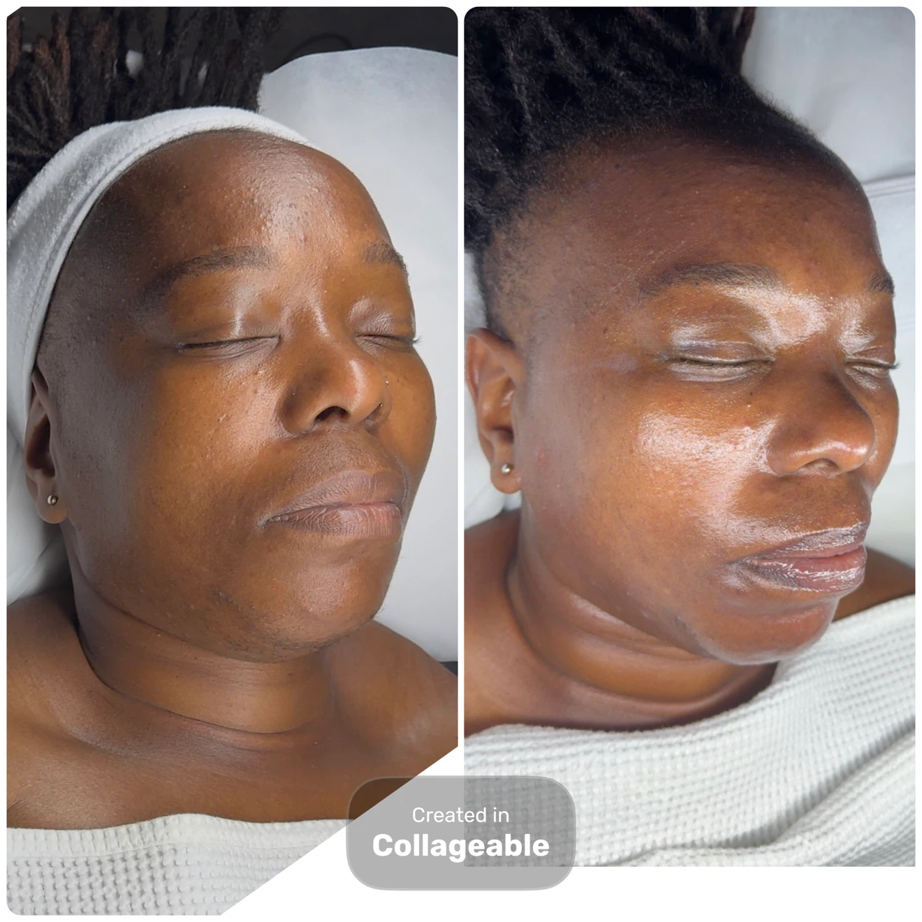 GlowVelle Facial & Skincare Services