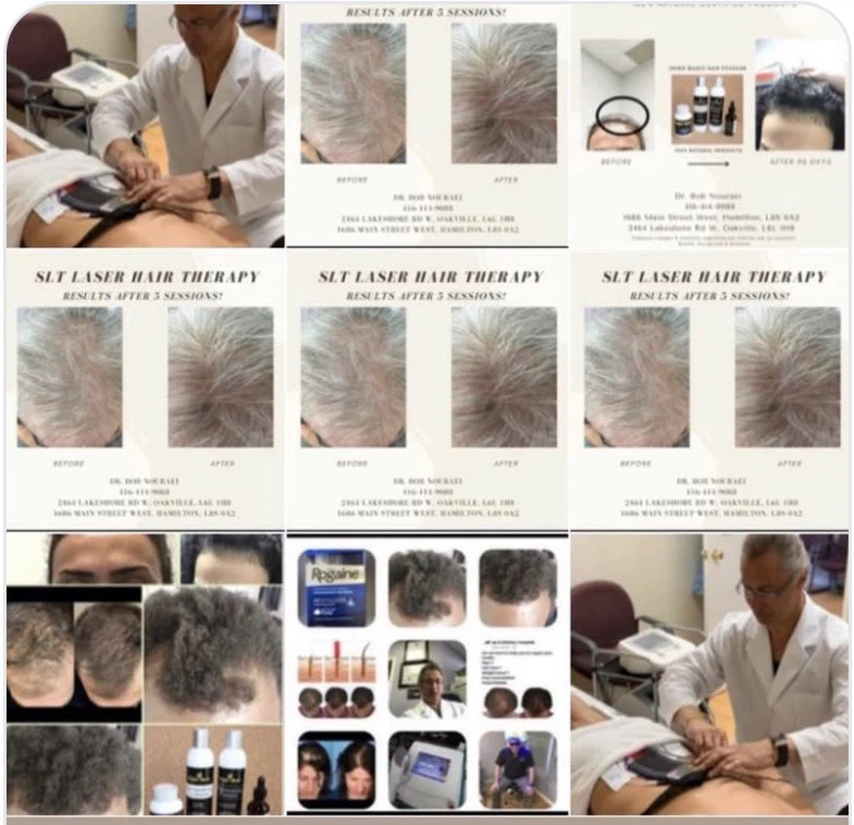 Minoxidil 5% - photo 5