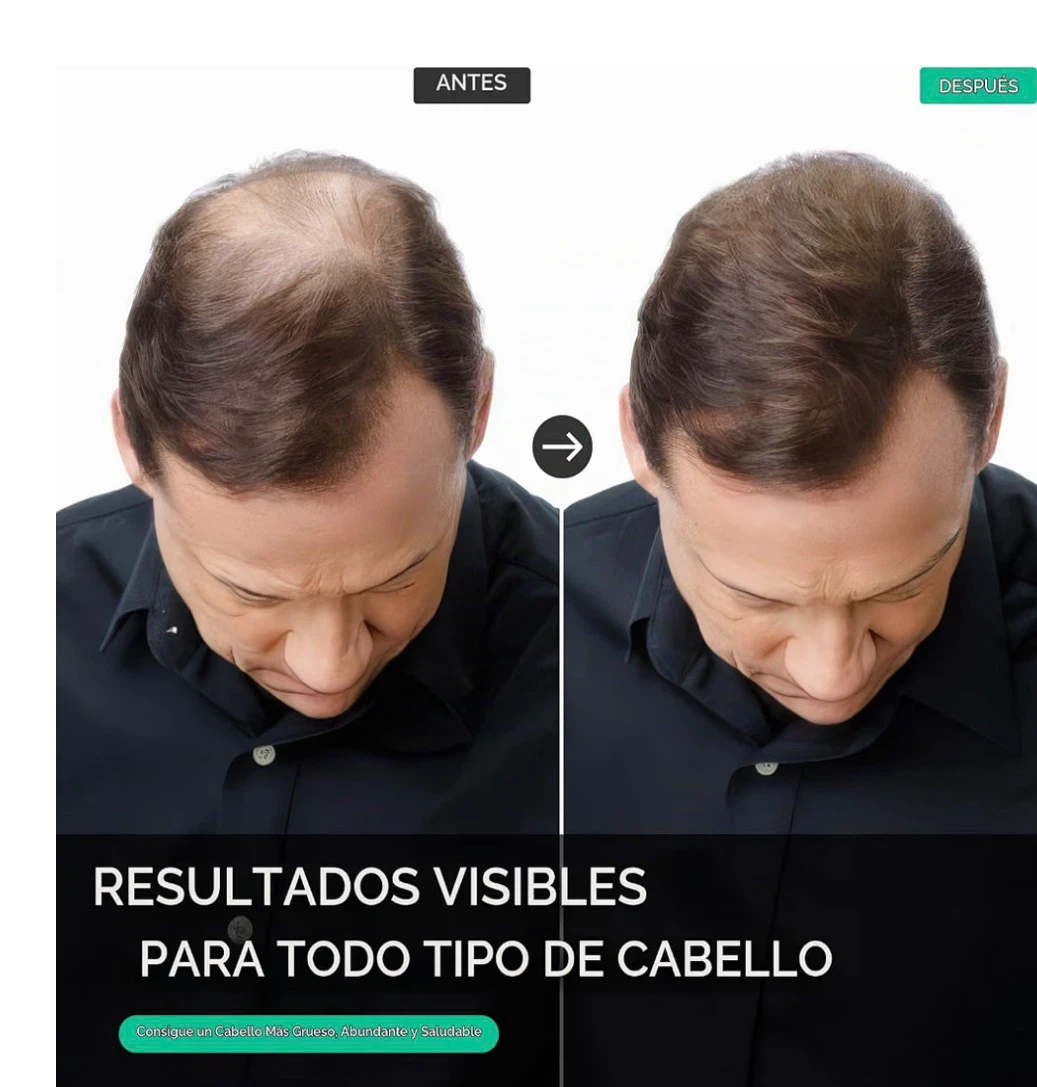 Set de champú y acondicionador activador de raíces Inlifay - photo 2
