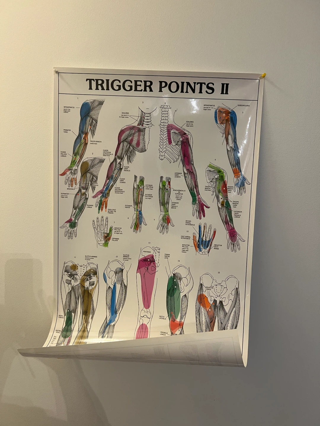 Trigger Points I & II Anatomical Posters (Set of 2)