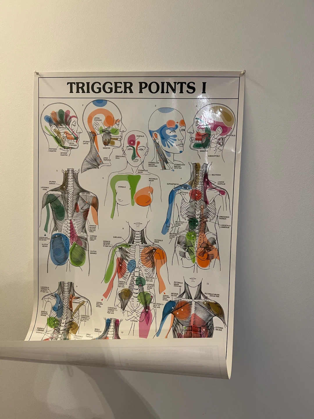Trigger Points I & II Anatomical Posters (Set of 2) - photo 2