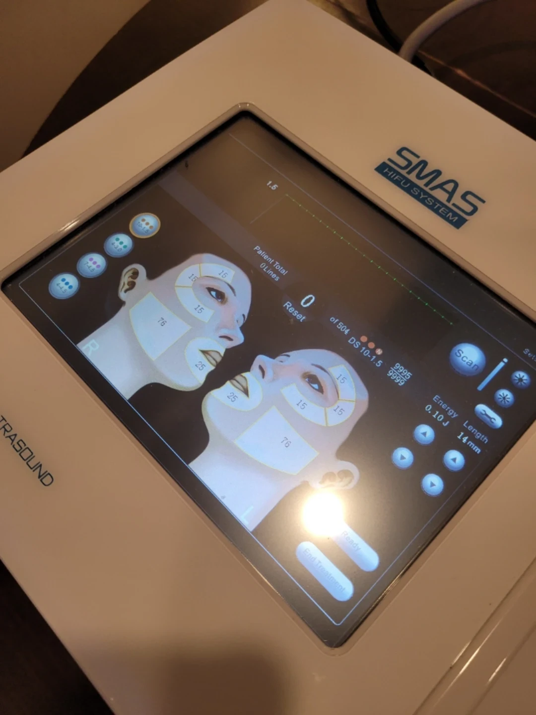 SMAS HIFU High-Intensity Focused Ultrasound Device / Ultherapy - photo 4