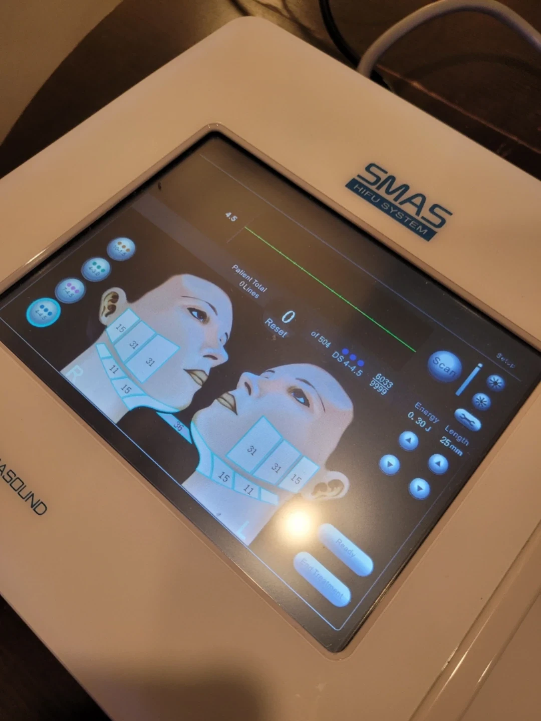 SMAS HIFU High-Intensity Focused Ultrasound Device / Ultherapy - photo 5