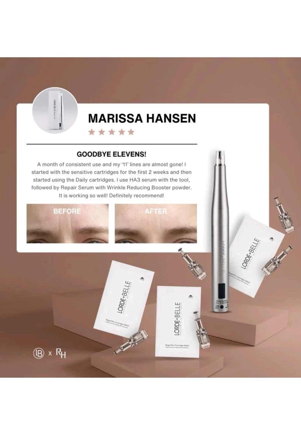 Lorde+Belle RegenPen Microneedling Device - photo 4