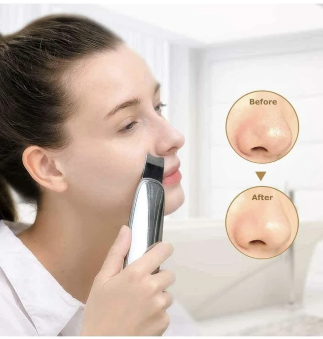 Touch Skin Beauty Ultrasonic Facial Scrubber - photo 2