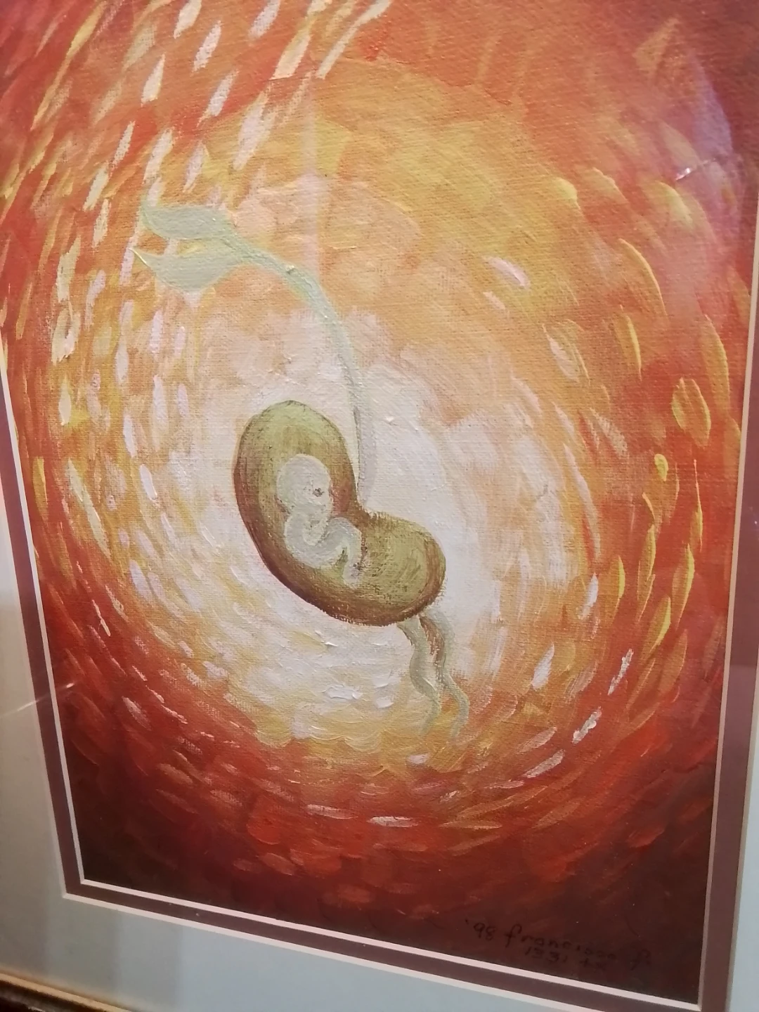 1998 Acrylic "Exciting Baby In Womb"80s Francisco Fagtanan - photo 2
