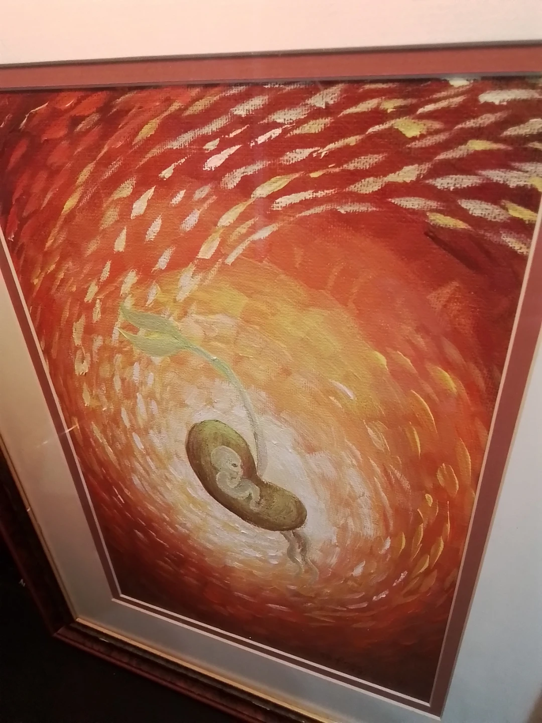1998 Acrylic "Exciting Baby In Womb"80s Francisco Fagtanan - photo 3
