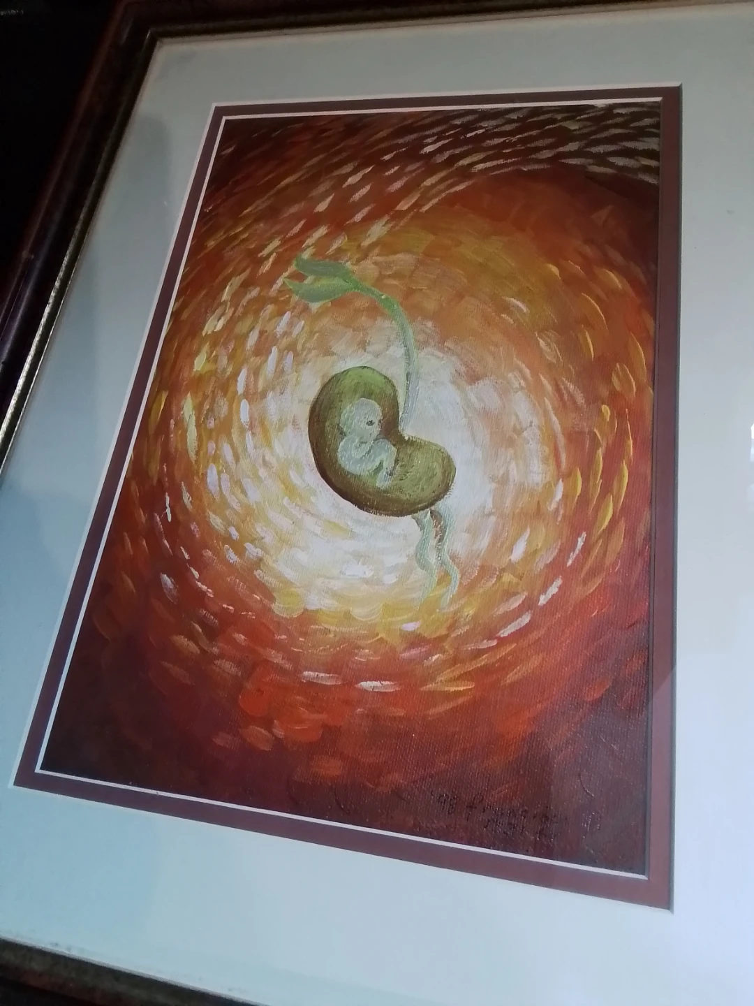 1998 Acrylic "Exciting Baby In Womb"80s Francisco Fagtanan - photo 4