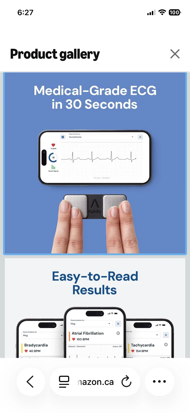 KardiaMobile 1-Lead ECG Monitor - photo 3