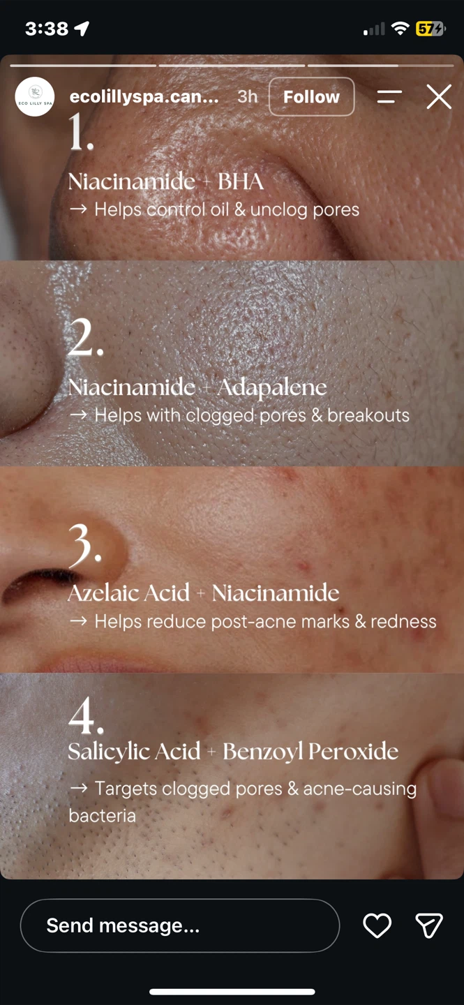 SKIN1004 Madagascar Centella Tea Tree+B5 Cream - photo 4