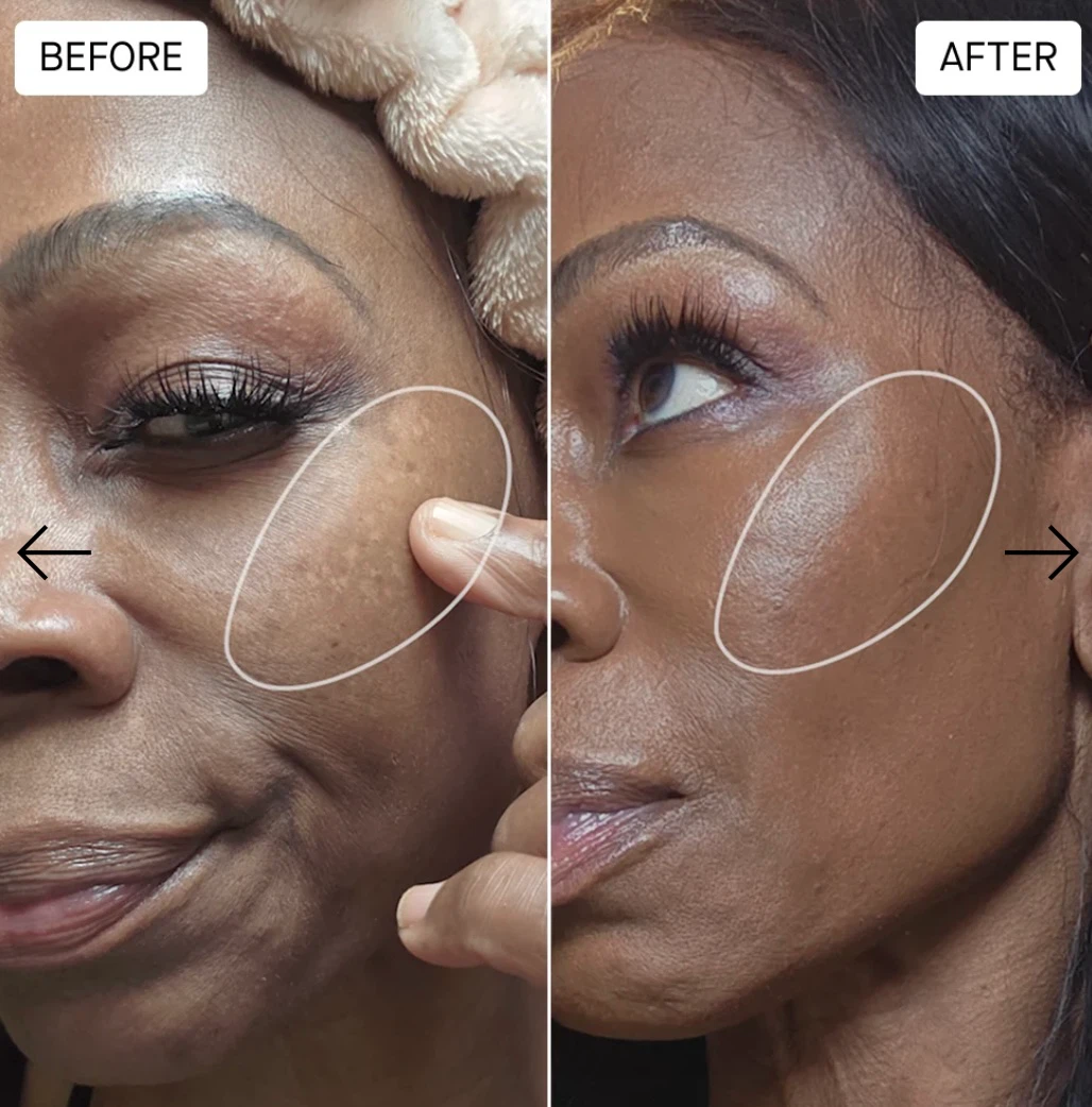 SPOILDCHILD M28 MicroSculpt Firming & Plumping Face Serum - photo 5